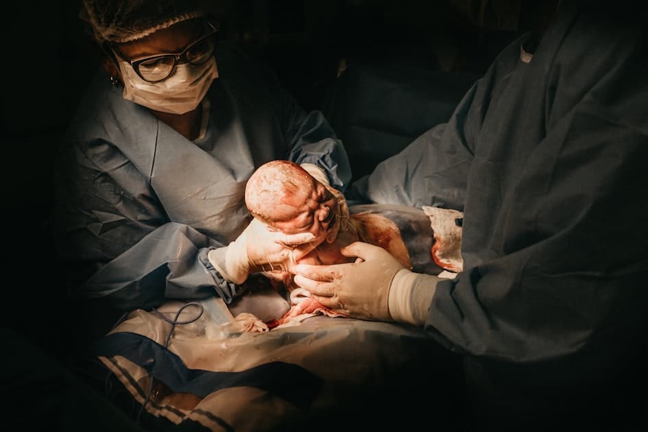 Umbilical Hernia in Babies: What It Is and When It Resolves